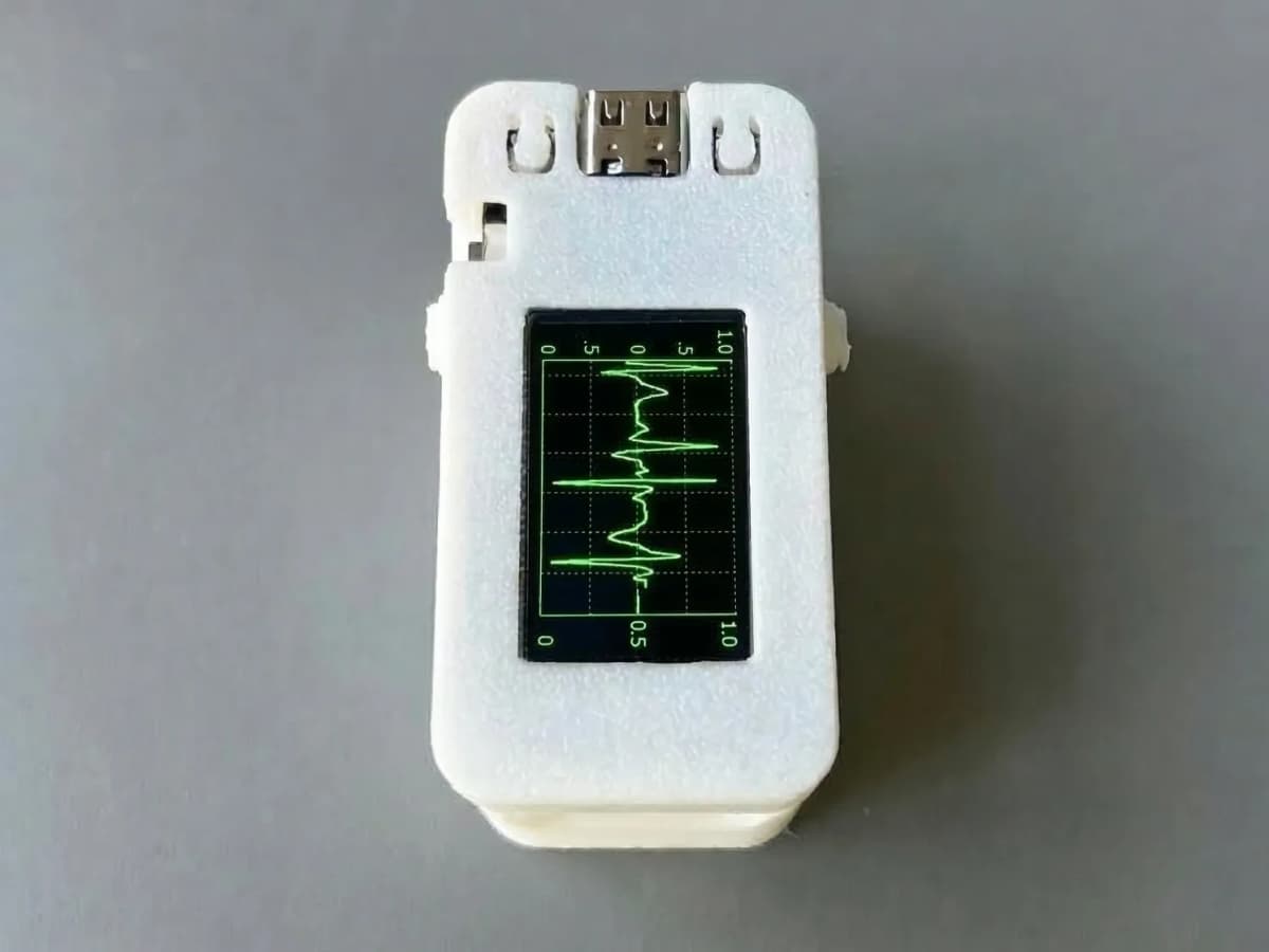 AI-Enabled Multi-Parameter Health Monitoring Wearable 1